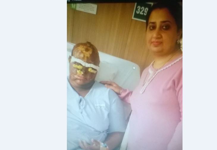 STEADY PROGRESS: Second Phase Of Acid Victim's Surgery Successful