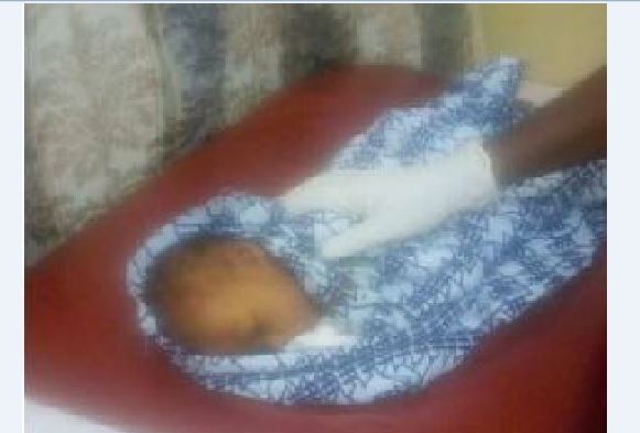 Baby buried alive rescued at Elmina