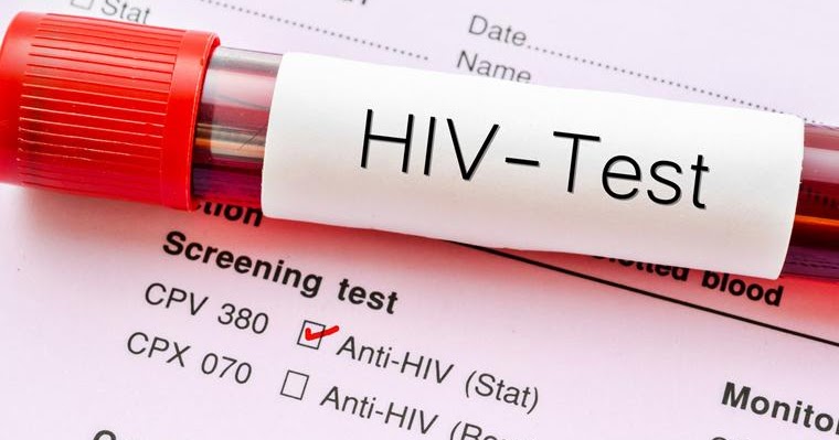 45% Ghanaians don’t know their HIV Status