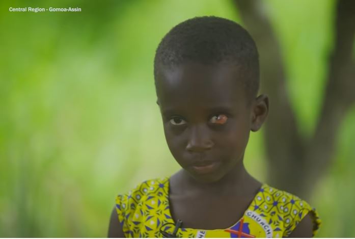 Vodafone Healthline Saves 5-year-old with Eye tumour