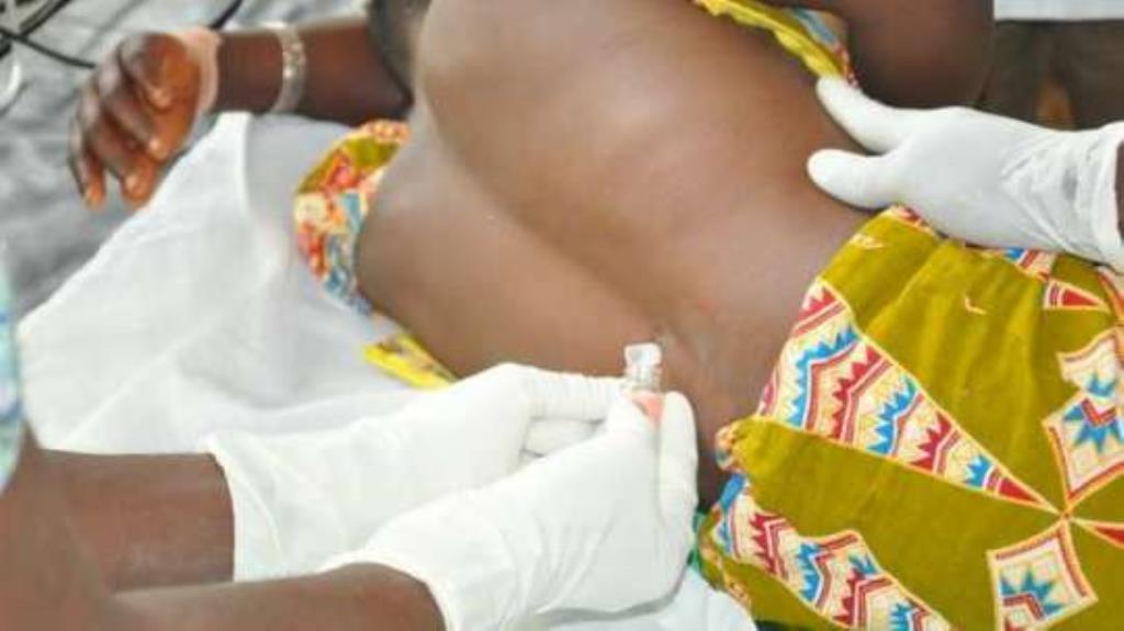 Meningitis cases in Upper West  hit 303 with 44 deaths