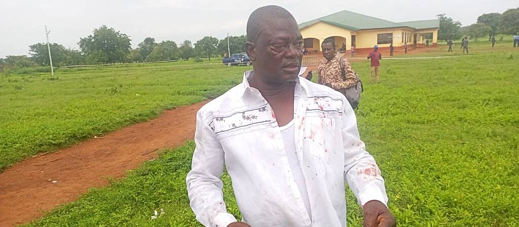 NPP Polls: Campaign coordinator for Alan Kyeremanten assaulted in North East Region