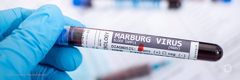 Tanzania confirms Marburg virus outbreak after initial denial