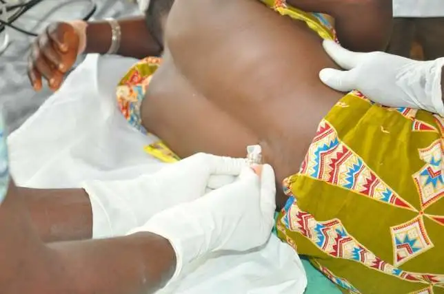 GAMLS raises concern over cerebrospinal meningitis outbreak in Northern Ghana